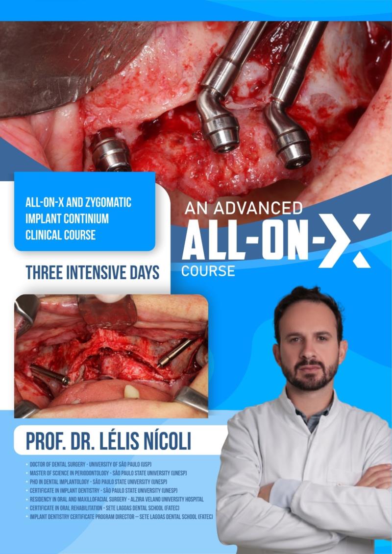  ALL- ON -X AND ZYGOMATIC IMPLANT CONTINIUM CLINICAL COURSE IMPLANT